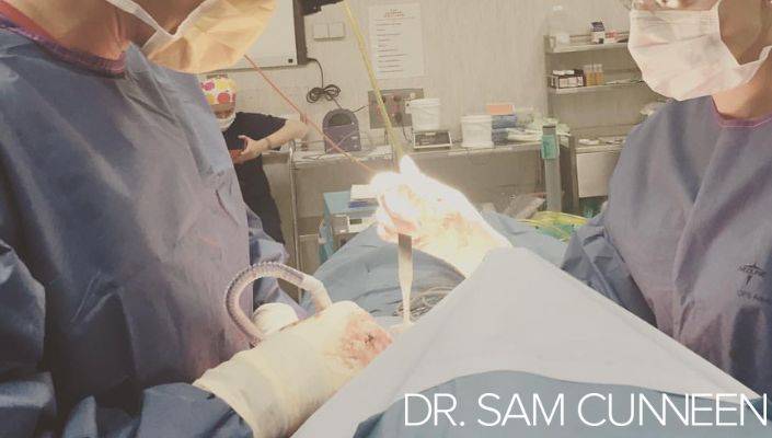 Sam Cunneen Plastic Surgeon